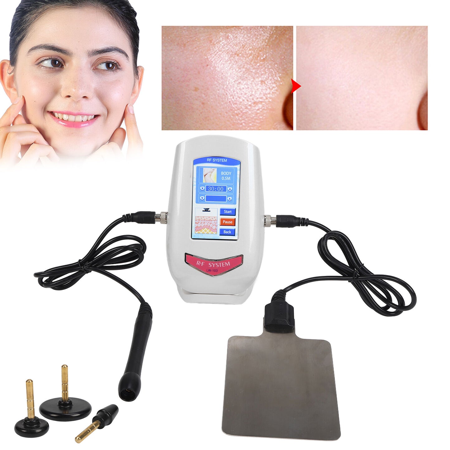 new RF Electric Machine Facel Lifting Firming Massage Instrument (EU Plug ) HGF koeek - KOEEK