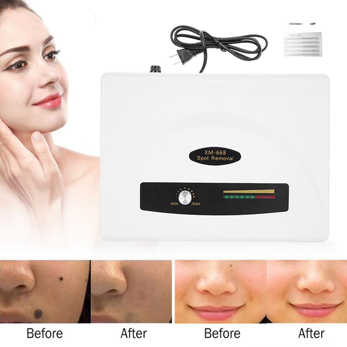 ny Ultrasonisk flekkfjerningspenn Large Power Freckle Mole Removing Home Spa Machi US