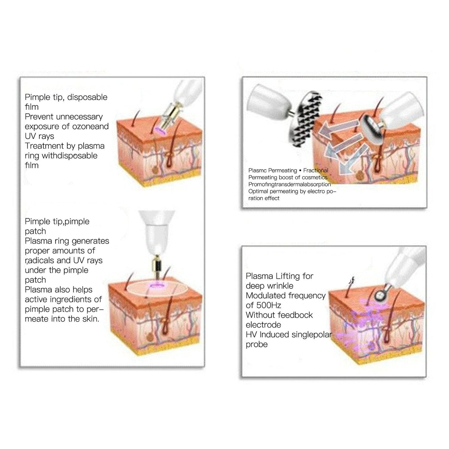 ny Plasma Pimple Removal Pen Pulse USB Oppladbar Bærbar Hudstramming US