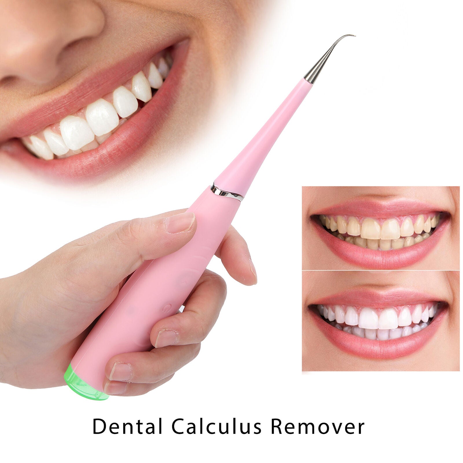 ny Elektrisk Dental Calculus Remover Plaque Tartar Cleaner Tannrenseverktøy F ABE