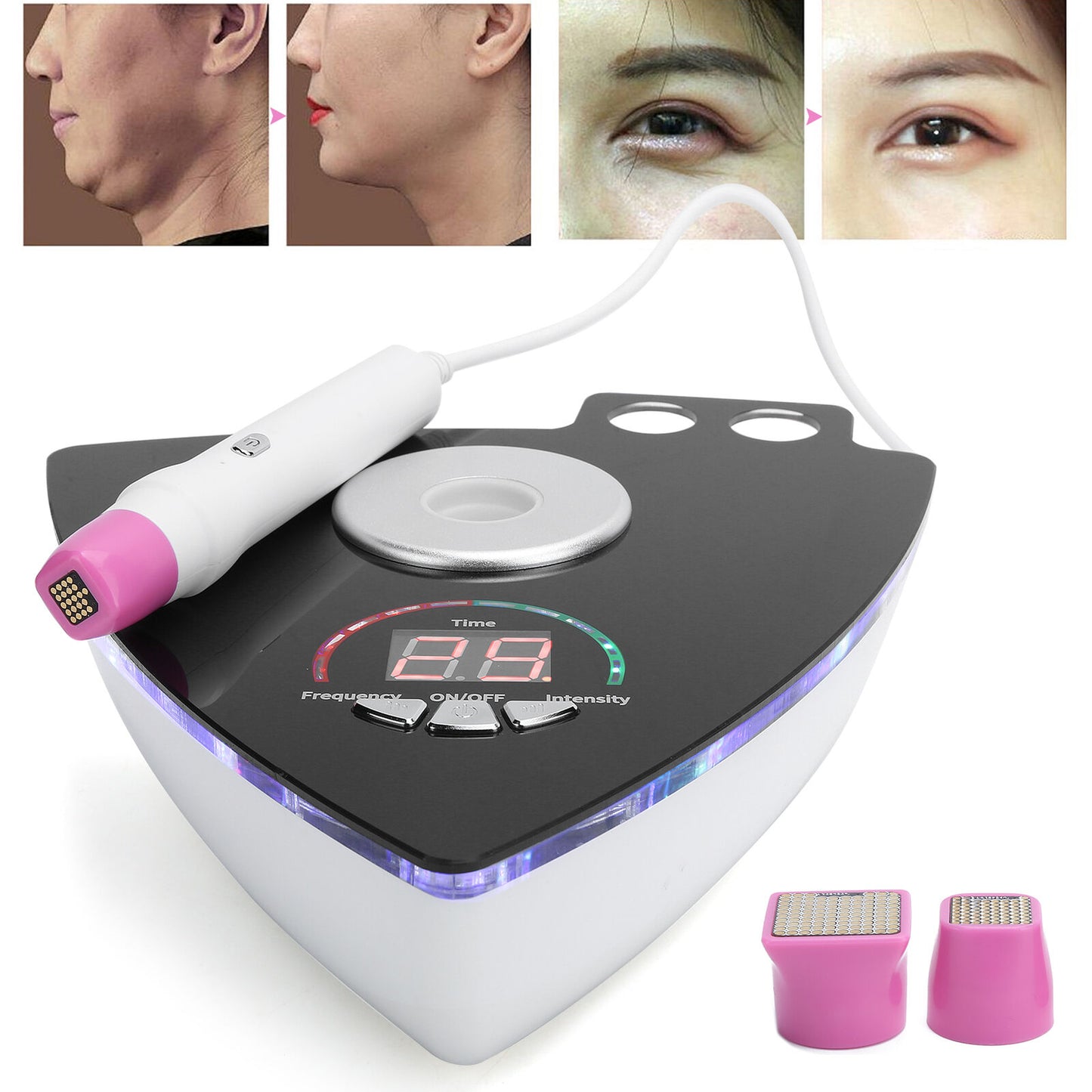 ny Skin Rejuvenation Machine Eye Face Body Skin Lifting Anti Aging Machine