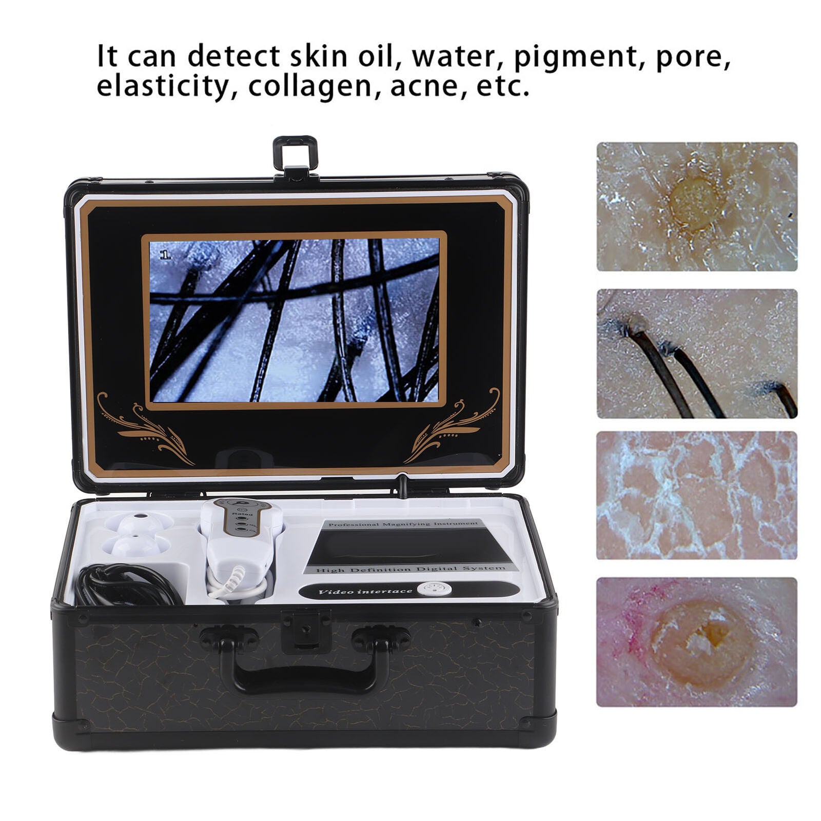 new Professional 50X 200X Skin Hair Scalp Detector Analyzer Microscope Skin Care koeek - KOEEK