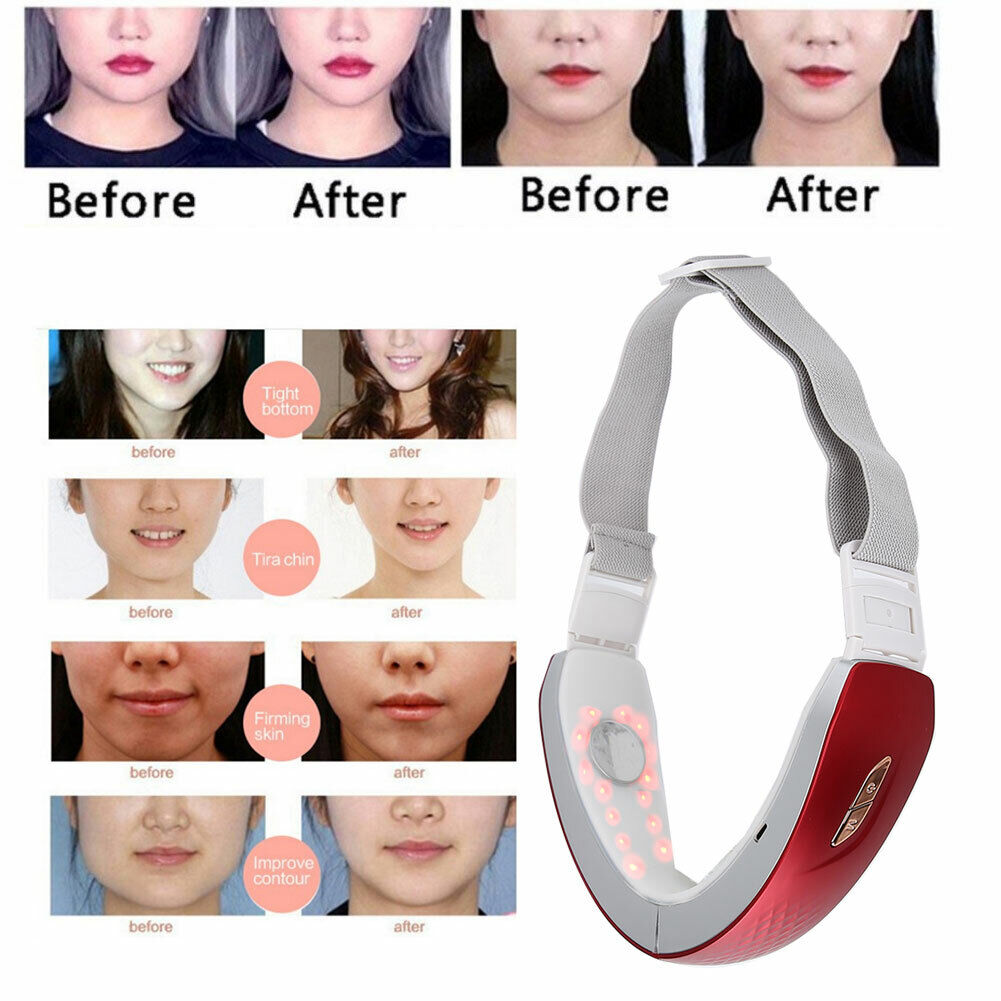 new Electric V-Face Slimming Red Blue Light Vibration Massage Skin Lifting Machine koeek - KOEEK