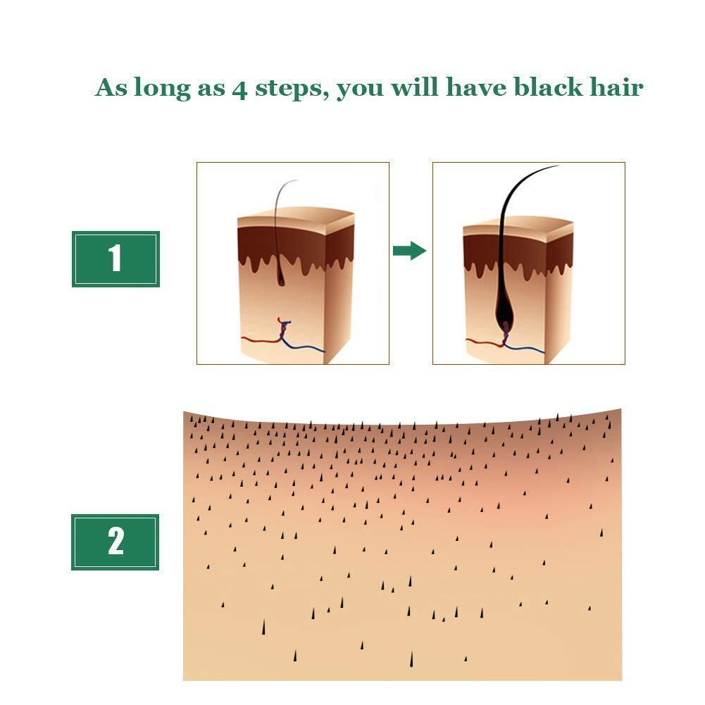 new 5 PACK Hair Growth Serum Liquid Loss Treatment for Women & Men Dense...
