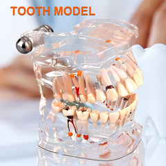 new Dental Teaching Study Standard Tooth  Demonstration Disease Educational koeek - KOEEK