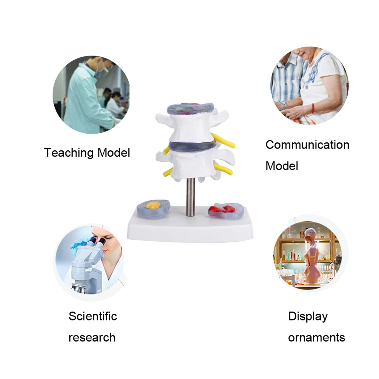 new Anatomical Lumbar Disc Herniation Demonstration Model Human Spine School A koeek - KOEEK