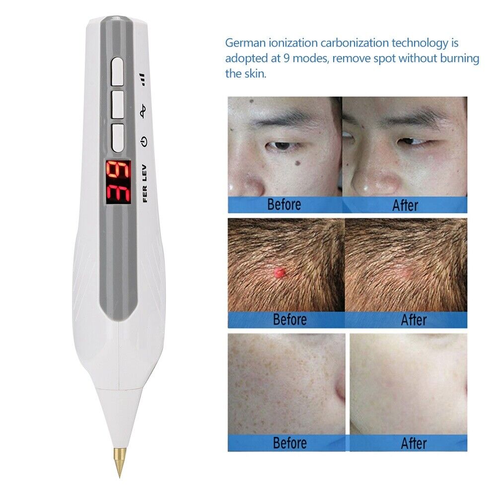 new Electric Cautery Spot Pen Warts Freckle Tattoo Removal Machine USB Charge FOD koeek - KOEEK