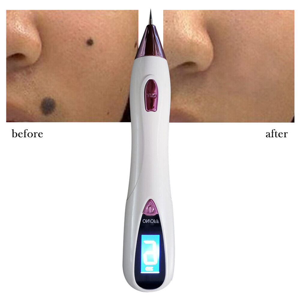 ny Electrico Laser Verrugas Quita Remover Pen Para Mezquinos Maquina Elimina Pecas