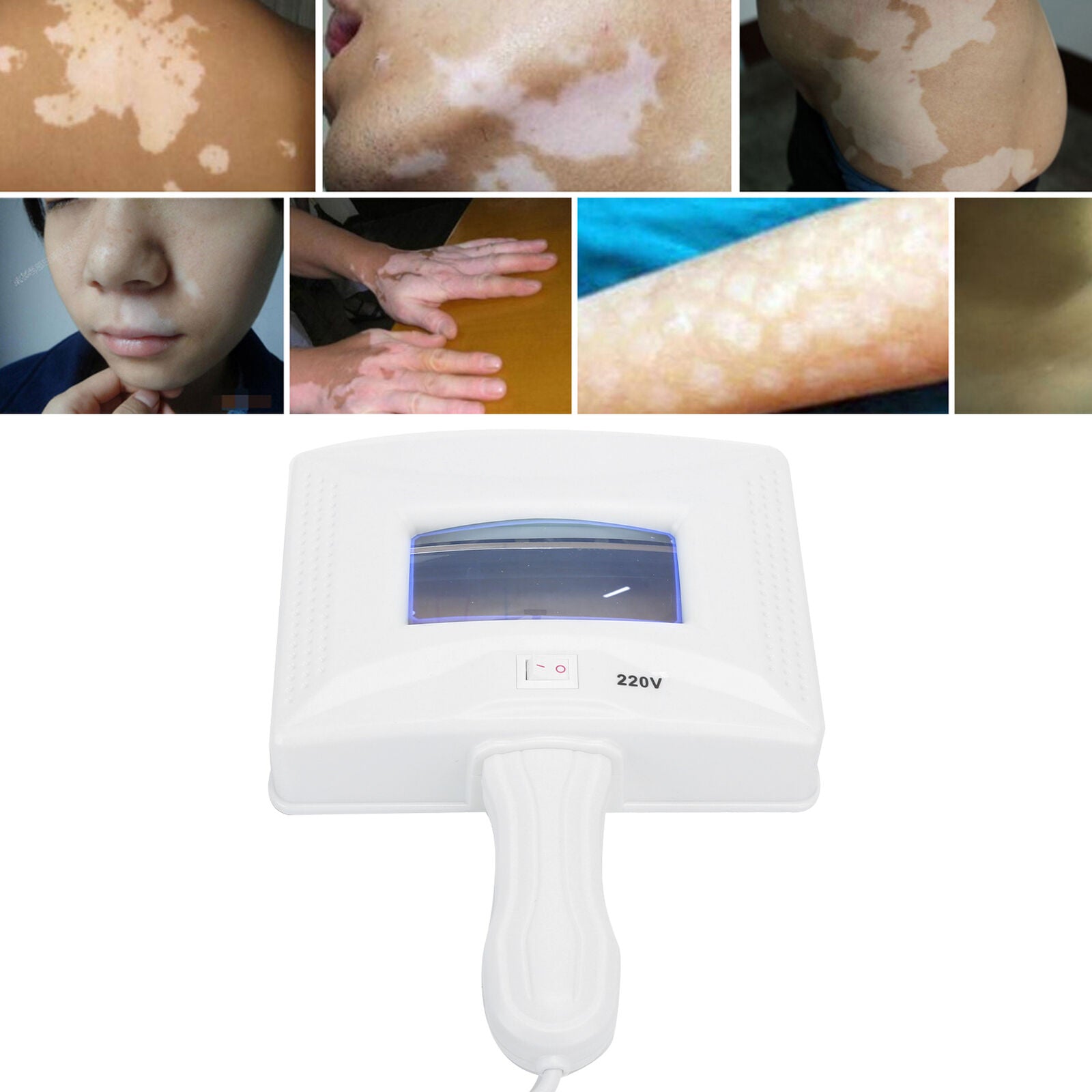 new EXAM Wood Lamp Skin Care UV Magnifyinglyzer Facial Beauty SPA Salon Machine HGF koeek - KOEEK