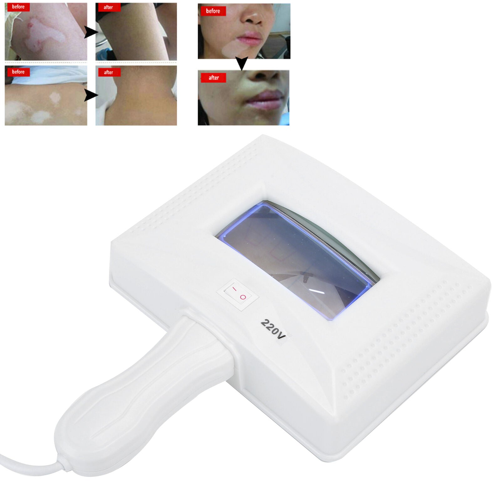 new EXAM Wood Lamp Skin Care UV Magnifyinglyzer Facial Beauty SPA Salon Machine HGF koeek - KOEEK