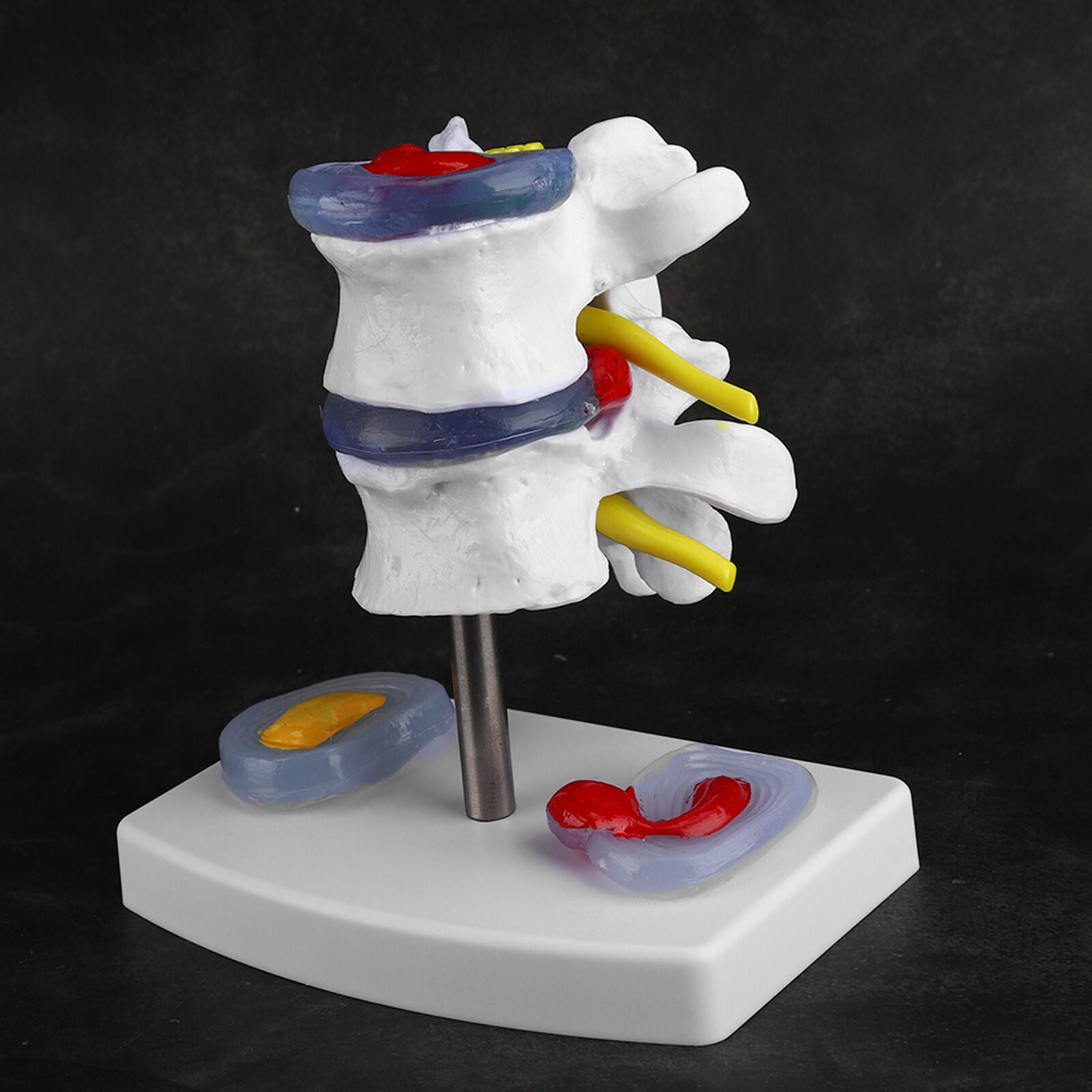 new Anatomical Lumbar Disc Herniation Demonstration Model Human Spine School A koeek - KOEEK