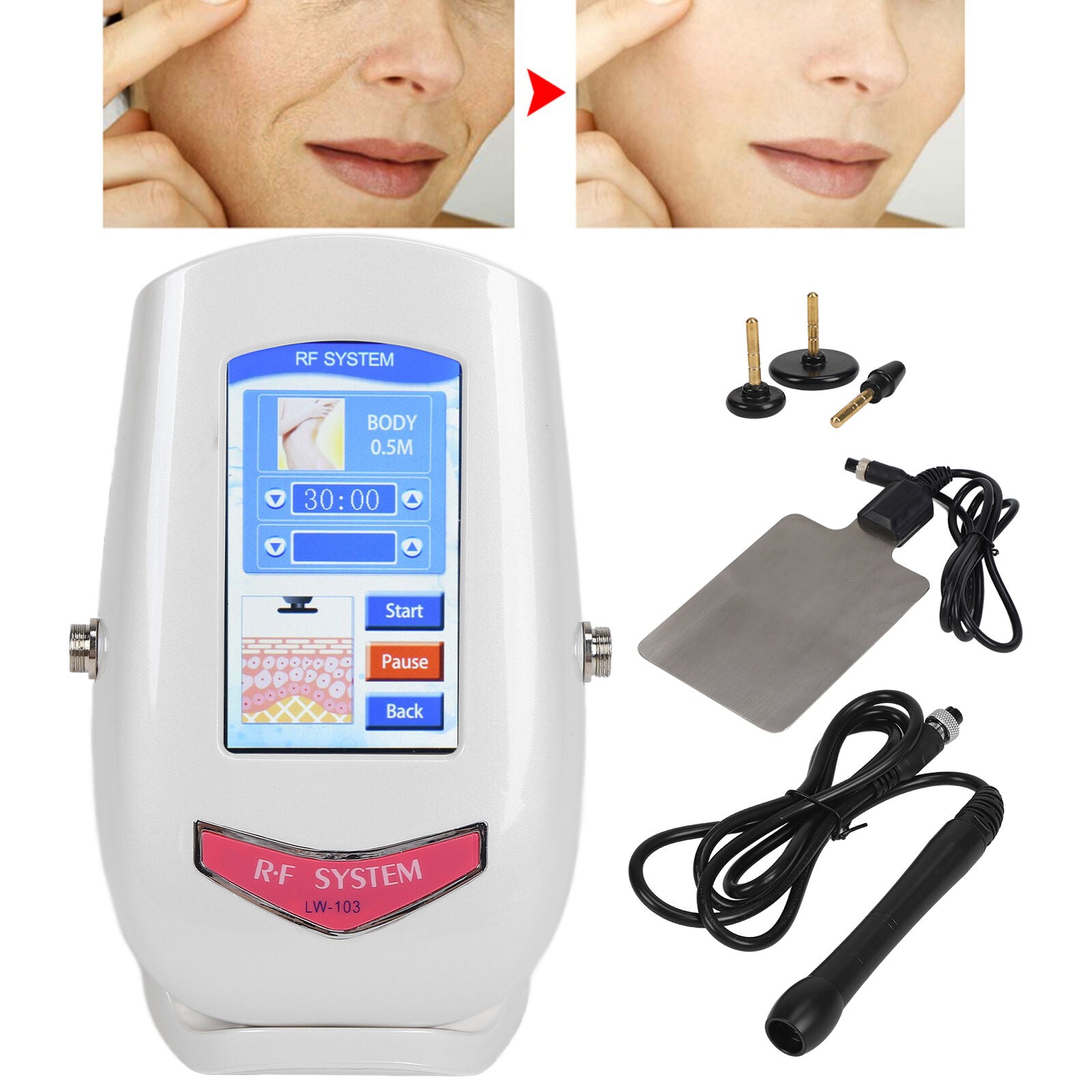 new RF Electric Machine Facel Lifting Firming Massage Instrument (EU Plug ) HGF koeek - KOEEK