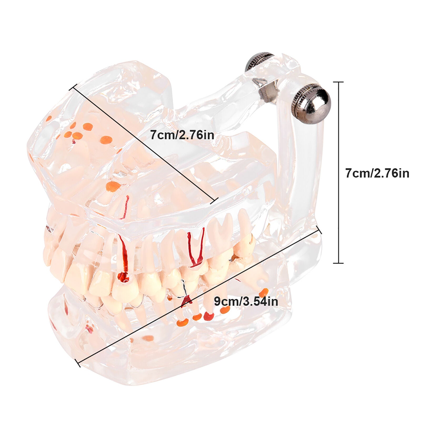 new Dental Teaching Study Standard Tooth  Demonstration Disease Educational koeek - KOEEK