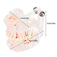 new Dental Teaching Study Standard Tooth  Demonstration Disease Educational koeek - KOEEK