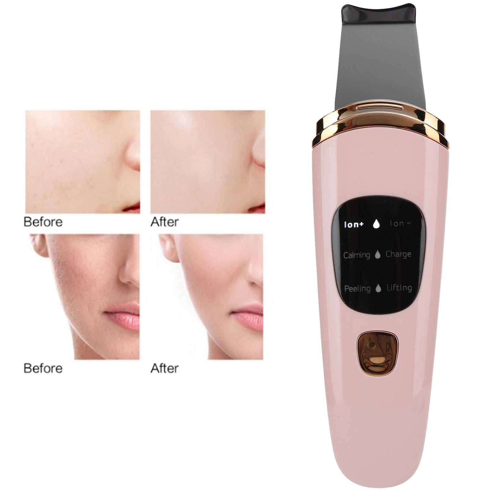 new Ultrasonic ScLCD Blackhead Removal Face ScLifting Machine(Pink ) HGF koeek - KOEEK