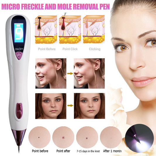 ny Electrico Laser Verrugas Quita Remover Pen Para Mezquinos Maquina Elimina Pecas