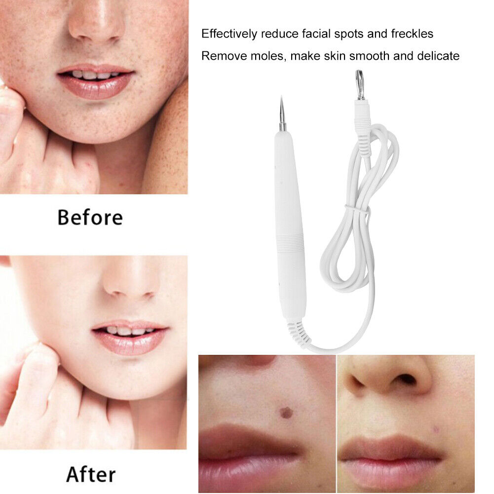 ny Ultrasonic Beauty Instrument Spots Mole Removal Pen Anti-Aging EU Plug 220V