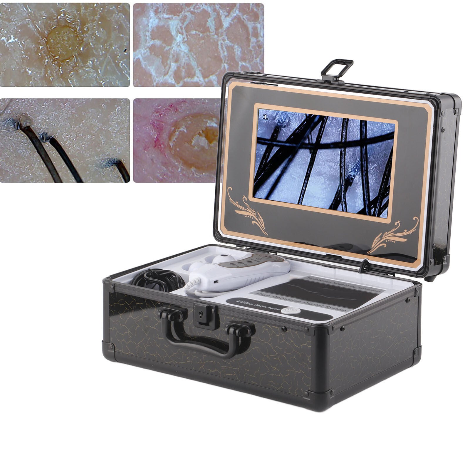 new Professional 50X 200X Skin Hair Scalp Detector Analyzer Microscope Skin Care koeek - KOEEK