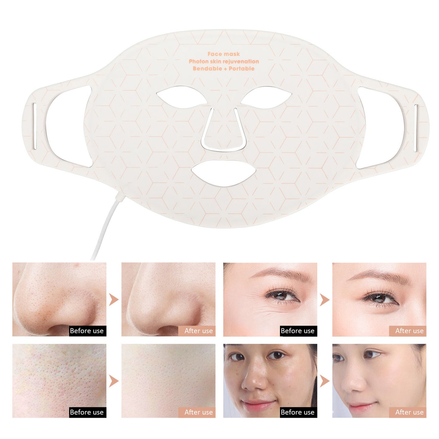 ny Lett ansiktspleiemaskin Balanseolje Skin Photon Face Rejuvenation Machine