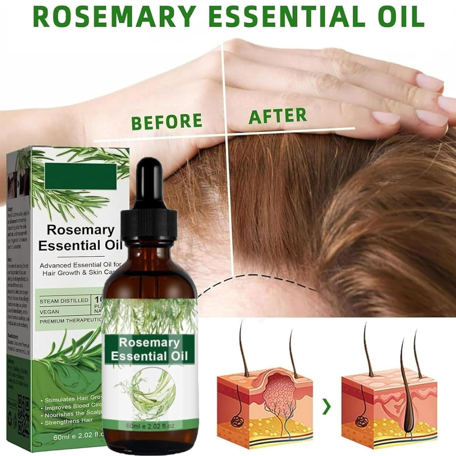 new Aceite de Romero para El Cabello, Crecimiento, 1 PCS 07FC0E-D4 - KOEEK
