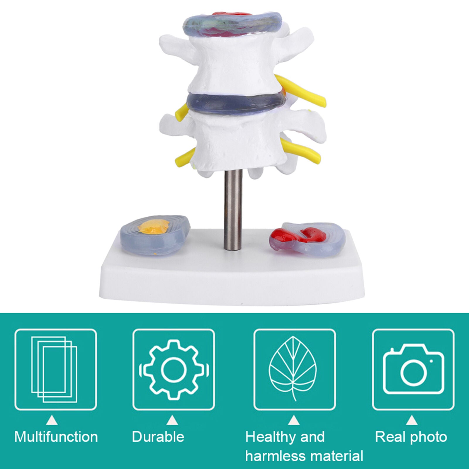 new Anatomical Lumbar Disc Herniation Demonstration Model Human Spine School koeek - KOEEK