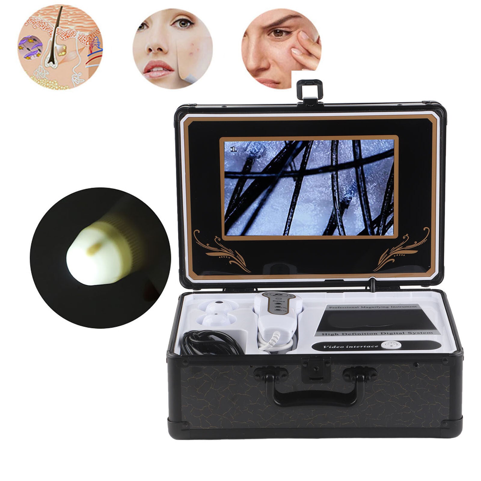 new Professional 50X 200X Skin Hair Scalp Detector Analyzer Microscope Skin Care koeek - KOEEK