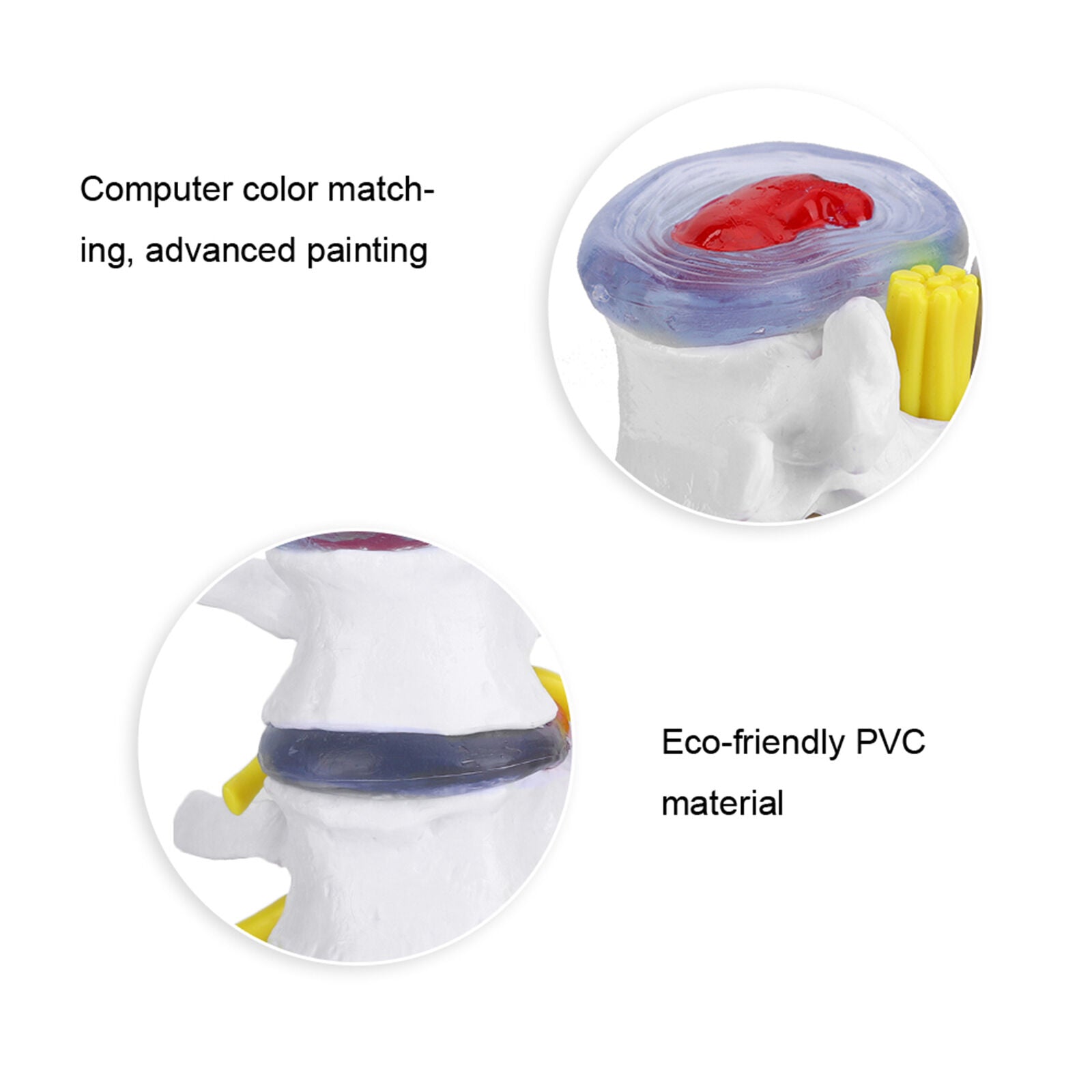 new Anatomical Lumbar Disc Herniation Demonstration Model Human Spine School US koeek - KOEEK