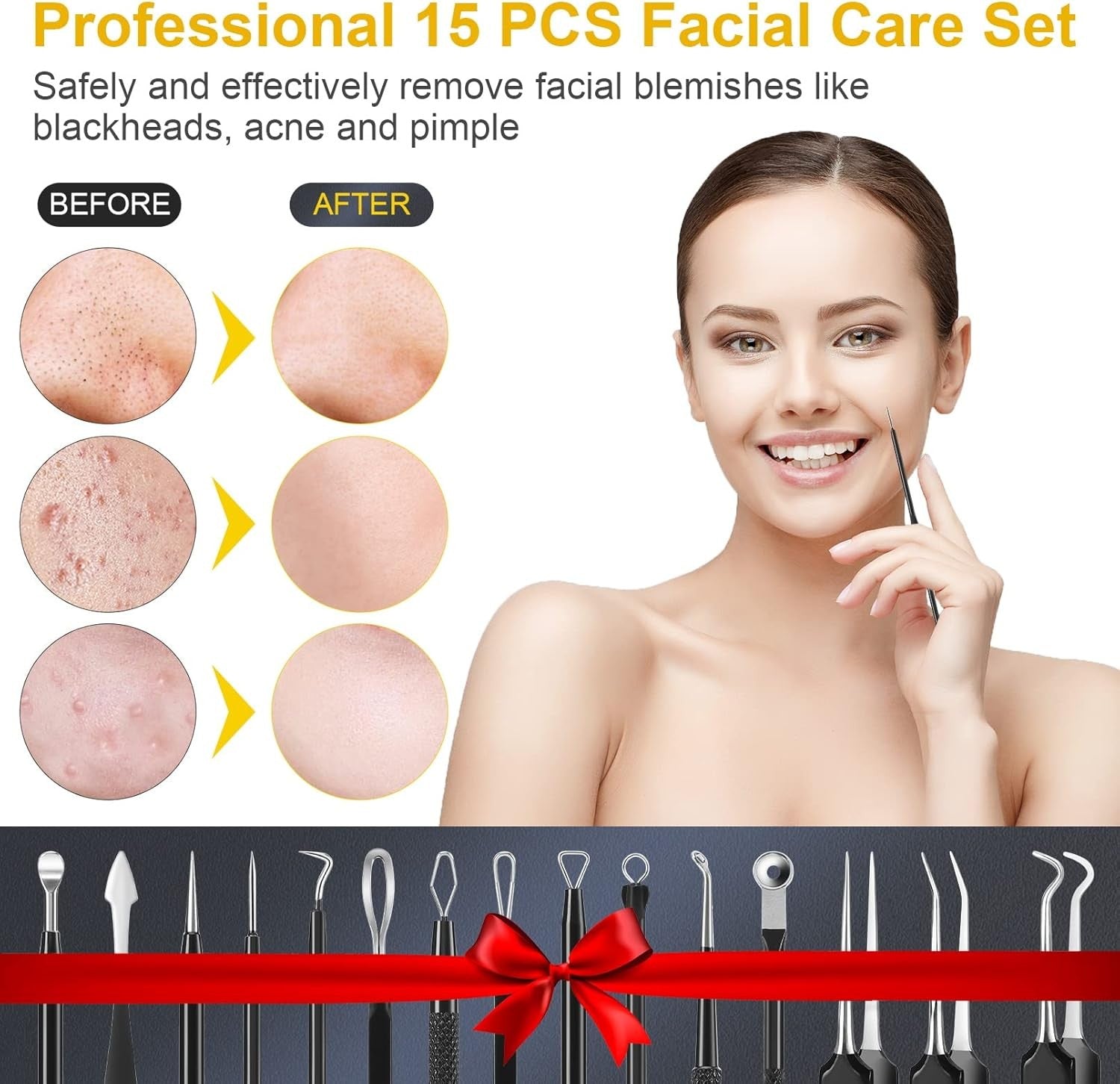 new Pimple Popper Tool Kit, IUMAKEVP 15 PCS Professional Stainless Steel Black IUMAKEVP - KOEEK
