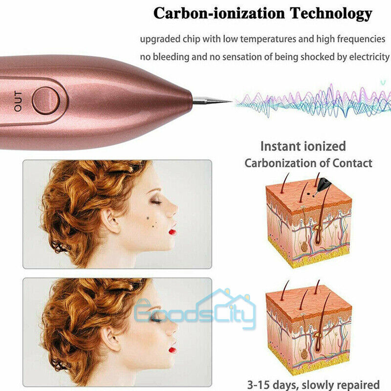 ny Maquina Laser Para Eliminar Pecas Manchas y Verrugas remoción de lunares LCD