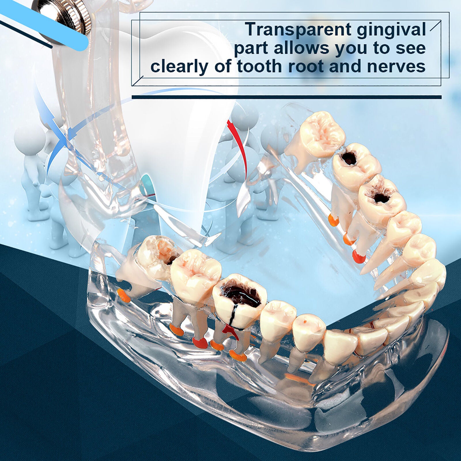 new Dental Teaching Study Standard Tooth  Demonstration Disease Educational koeek - KOEEK