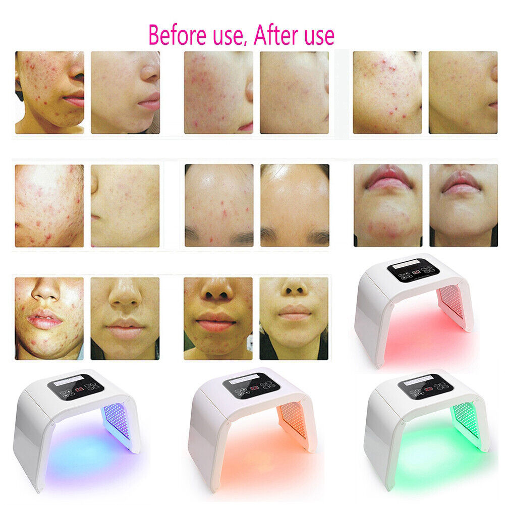 ny PDT 4Colors LED Light Photodynamic Facial Skin Care Rejuvenation Photon