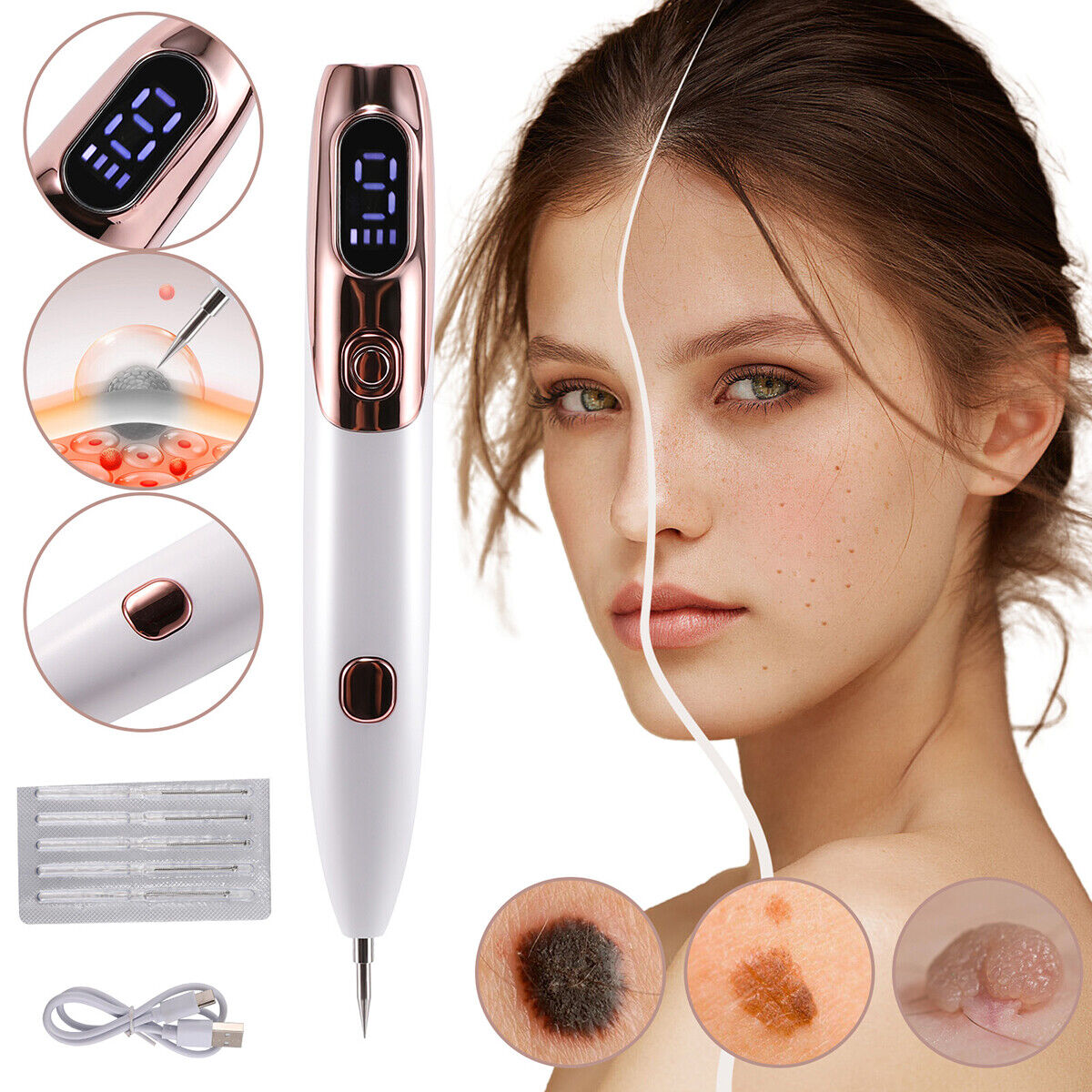 ny Laser Verrugas Quita Electrico Remover Pen Para Mezquinos Maquina Elimina Pecas