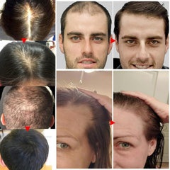 new Aceite de Romero para El Cabello, Crecimiento, 1 PCS 07FC0E-D4 - KOEEK