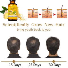 new 5 PACK Hair Growth Serum Liquid Loss Treatment for Women & Men Dense... 07FC0E-D4 - KOEEK