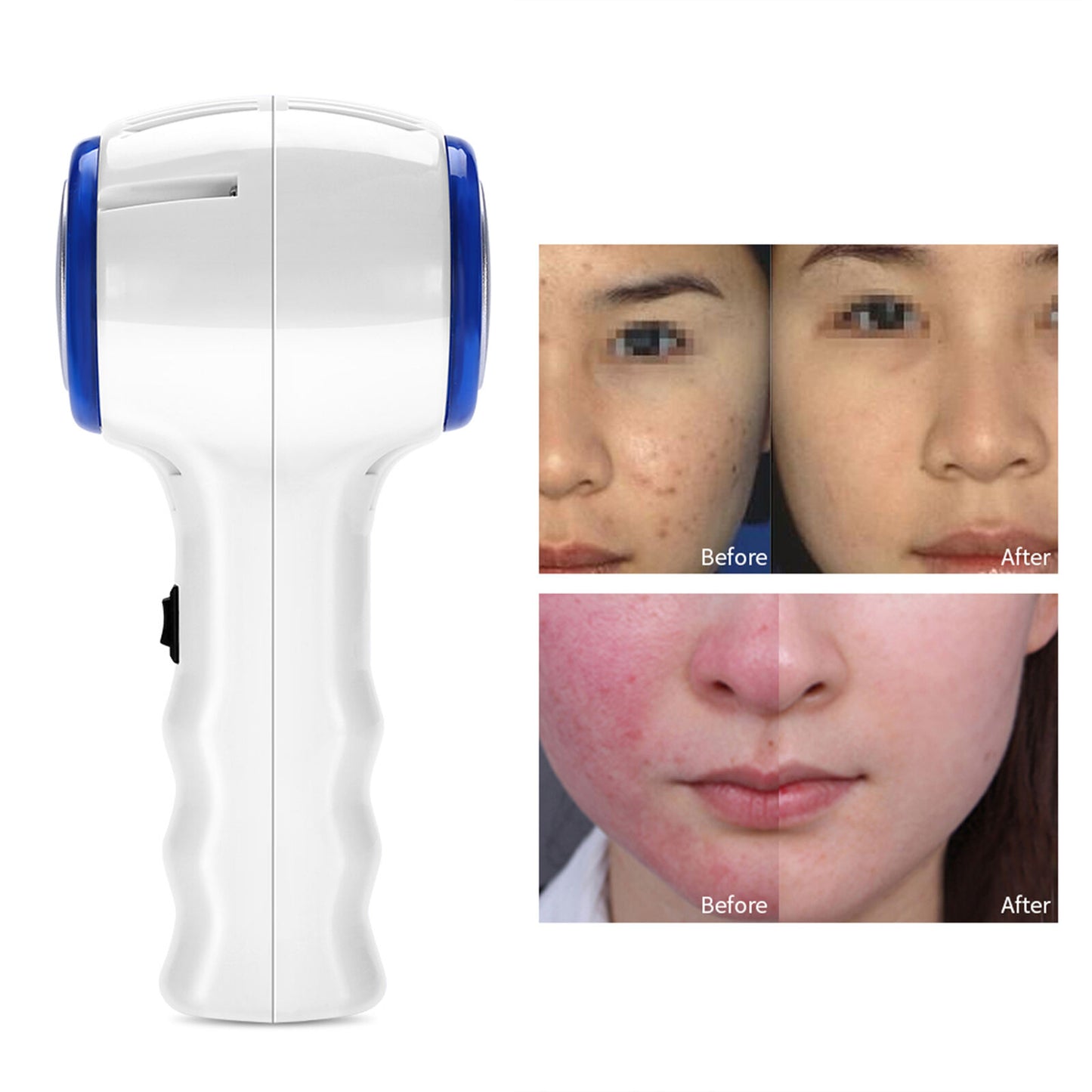 new Beauty Device Hot And Cold LED Hammer Cosmetic Facial Machine Face Skin Lift HGF koeek - KOEEK