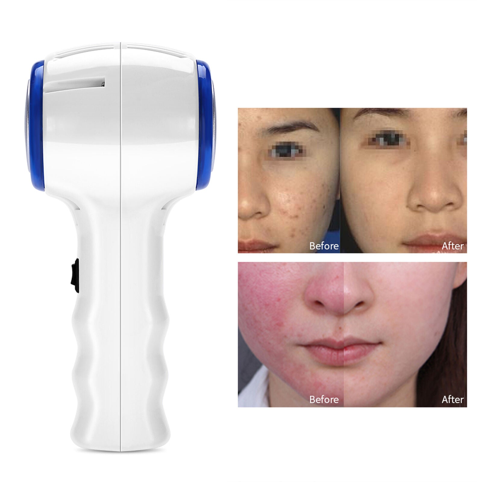 new Beauty Device Hot And Cold LED Hammer Cosmetic Facial Machine Face Skin Lift HGF koeek - KOEEK