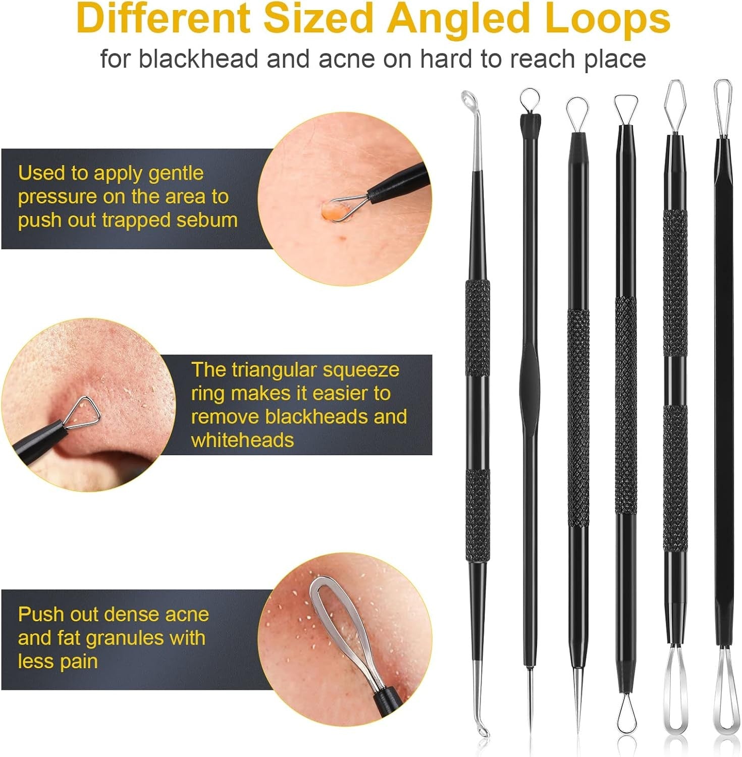new Pimple Popper Tool Kit, IUMAKEVP 15 PCS Professional Stainless Steel Black IUMAKEVP - KOEEK