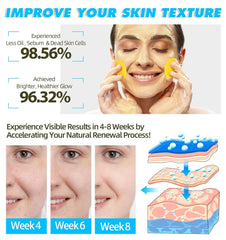 new 60PCS Turmeric Kojic Acid Pads,Turmeric Cleansing Pads, Face... 07FC0E-D4 - KOEEK